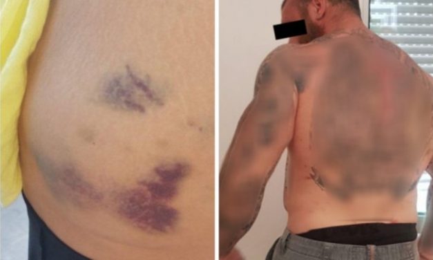 TUKAO ŽENU, BRATU SLOMIO NOS I LOBANJU! Specijalci sa dugim cevima hapsili nasilnika na Čukarici (UZNEMIRUJUĆE FOTOGRAFIJE)