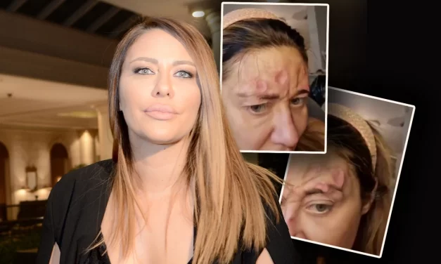 „KAO KRAVA KAD DA MLEKO, PA PROSPE!“ Poznati izneli podeljena mišljenja o slučaju Ane Nikolić