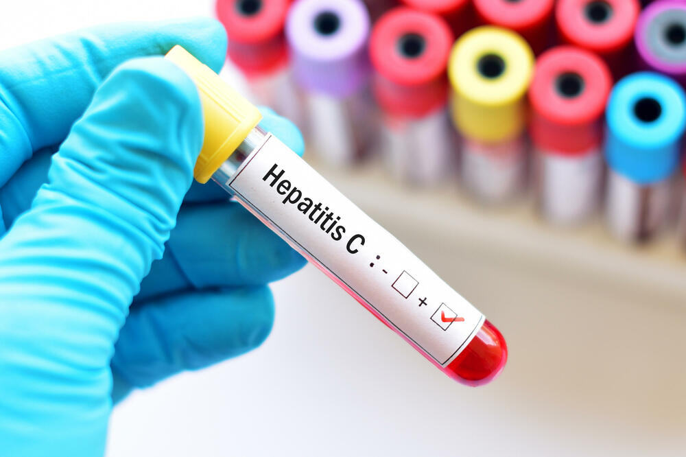 Procjenjuje se da 320 miliona ljudi širom svijeta ima hepatitis B…
