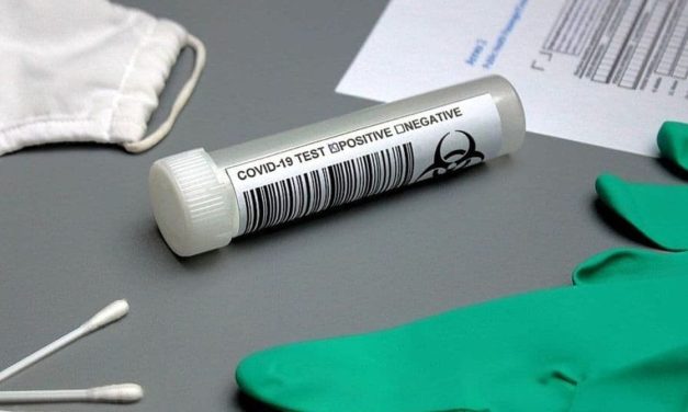 IJZ: Registrovano 137 novooboljelih od koronavirusa, bez smrtnih slučajeva
