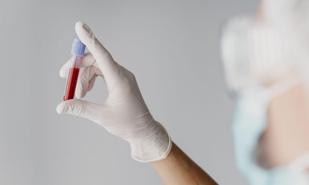 Koliko je inficiranih u Srbiji od kada je otkriven HIV?