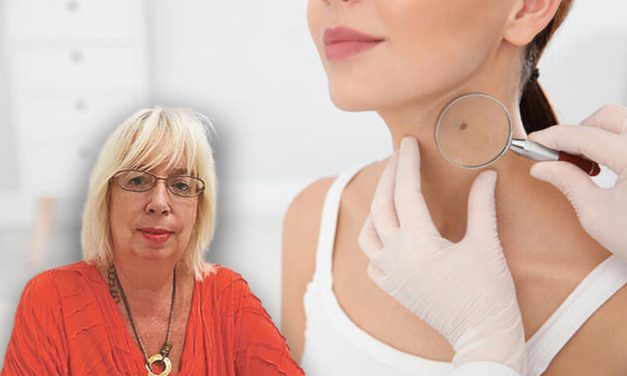 Kada je neophodno uklanjanje mladeža? Evo koje promene zahtevaju hitan pregled dermatologa