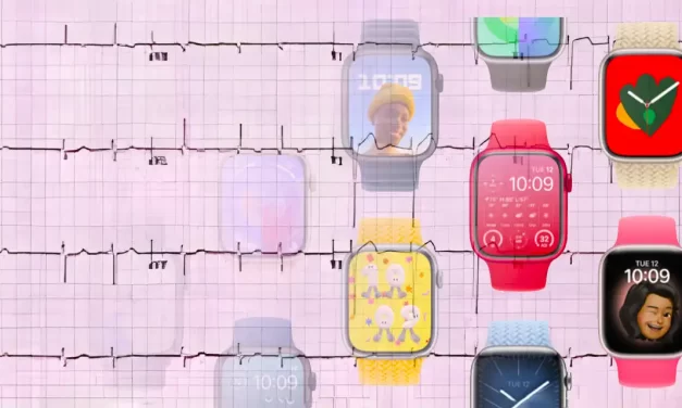 Apple Watch pomaže u otkrivanju i praćenju najčešćeg oblika aritmije