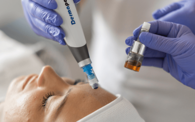 PBSerum za masne naslage: savremeno rešenje za oblikovanje tela bez operacije